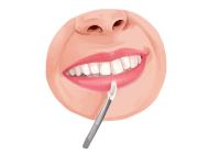 Dentist Hillcrest - Heathwood Smiles Dental image 3